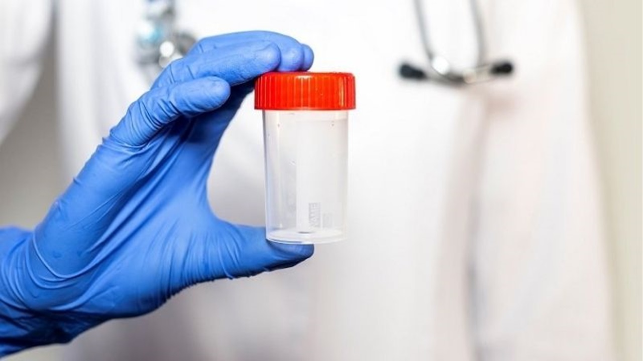Sperm Testi ile Hastalık Teşhisleri Çok Kolay Görseli