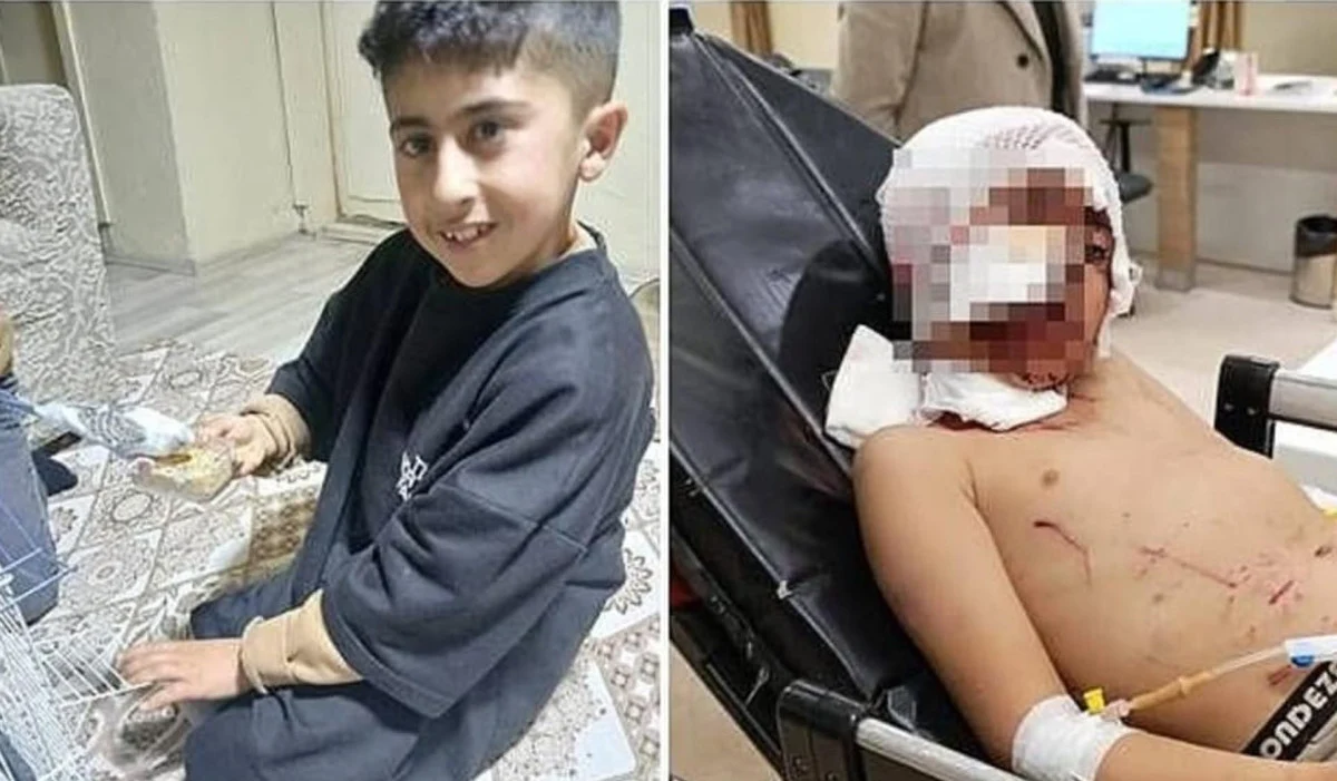 Başı boş köpekler can almaya devam ediyor! Görseli