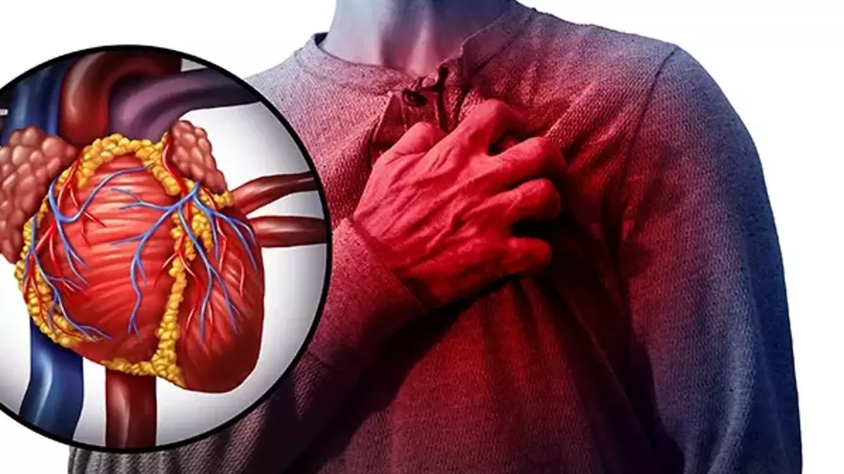 Aort Yırtılması Nedir? Belirtileri Nelerdir? Görseli